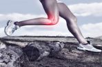 Did your knee function well after ACL reconstruction?
